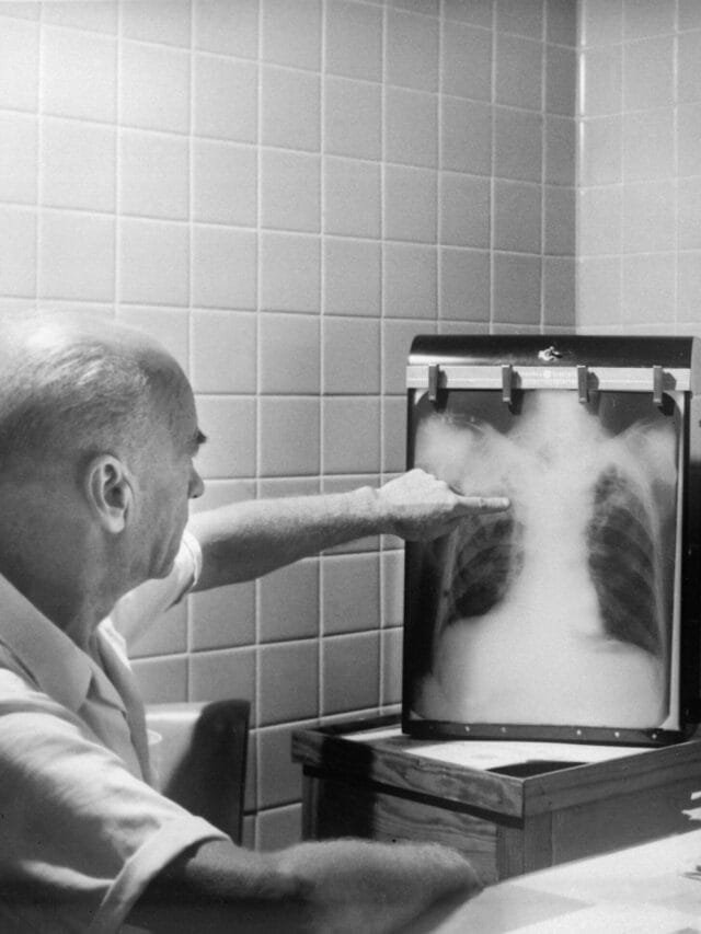 8 Essential Facts About Lung Cancer Survival You Should Know.