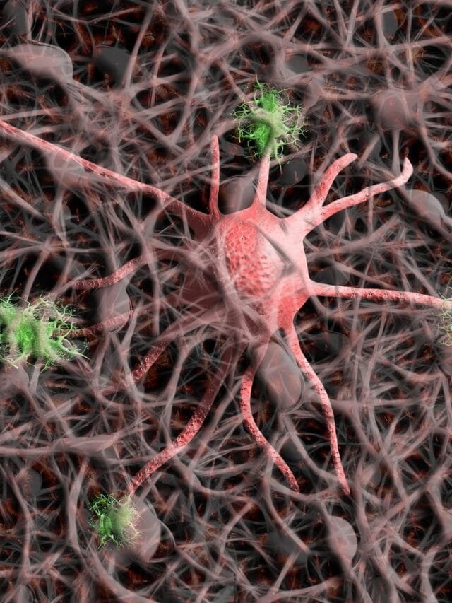 The Hidden Culprit Behind Alzheimer’s: 8 Key Facts